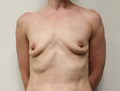 gallery-image