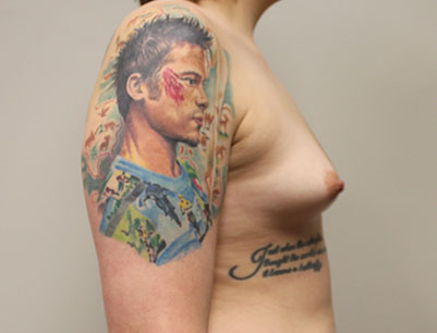 gallery-image