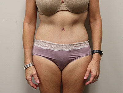 gallery-image