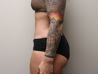 gallery-image