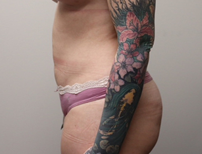 gallery-image