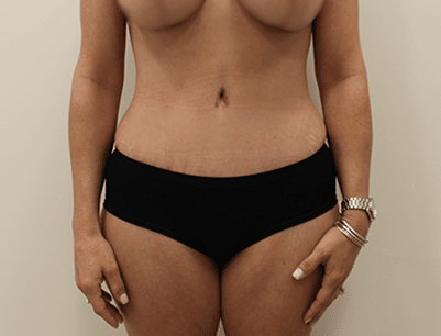 gallery-image