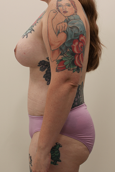 gallery-image